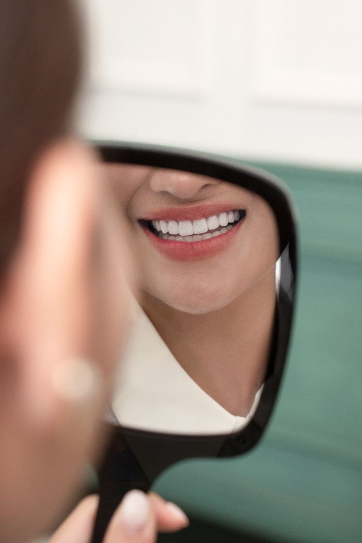 NEXO5 aligner treatment