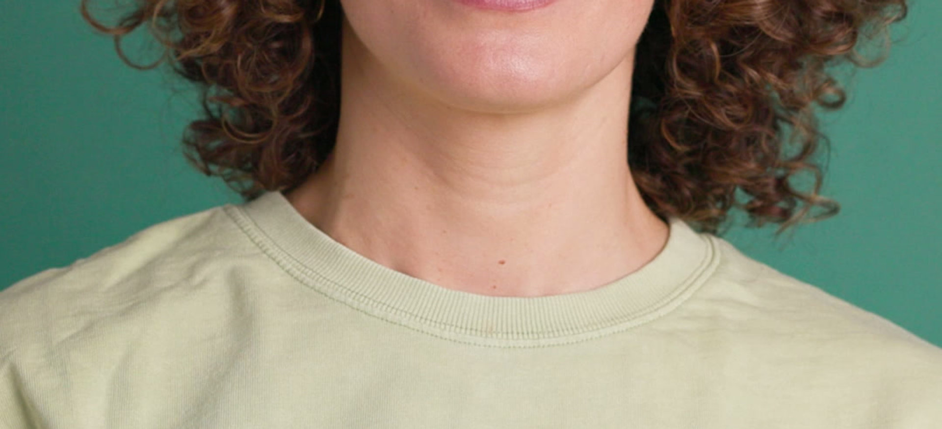 NEXO Aligners smile