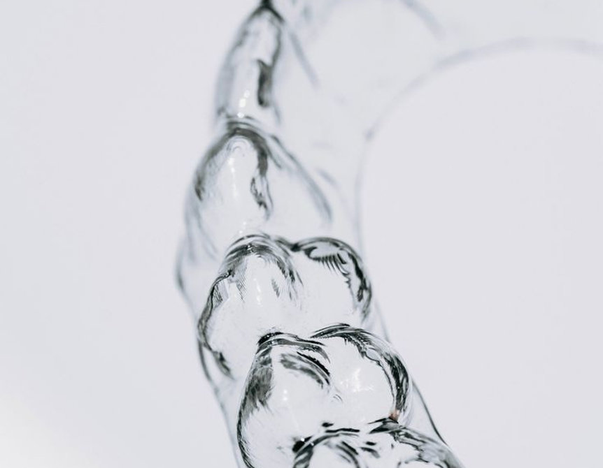 NEXO aligner